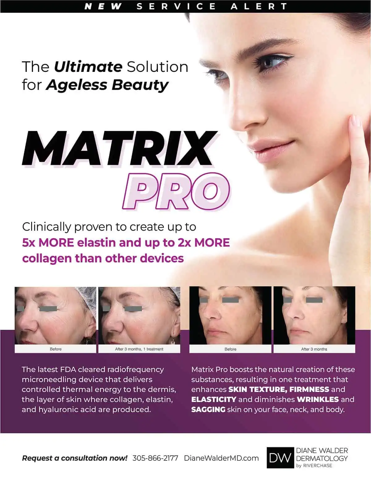 Matrix Pro™